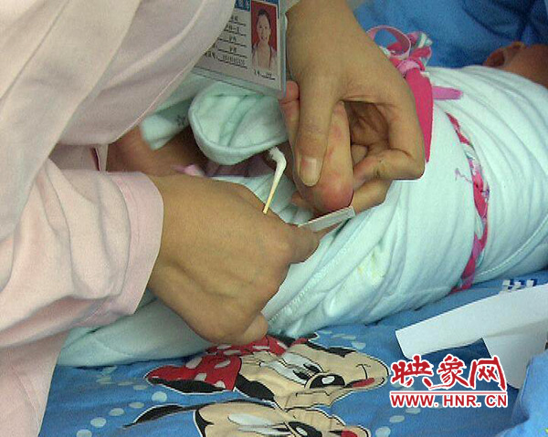 醫(yī)護(hù)人員在為一名新出生嬰兒采足跟血，做疾病篩查