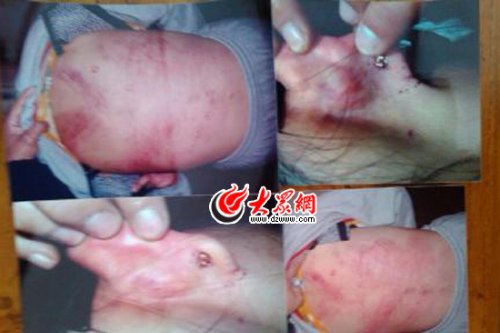　山東藝術(shù)設(shè)計學(xué)院16歲女生宿舍內(nèi)被女同學(xué)暴打4小時。