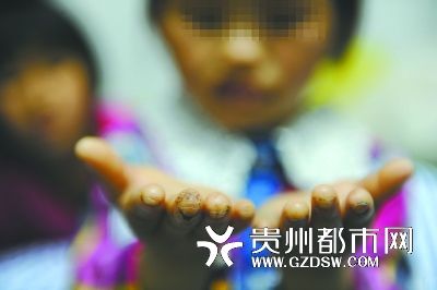 指尖被針扎得傷痕累累。