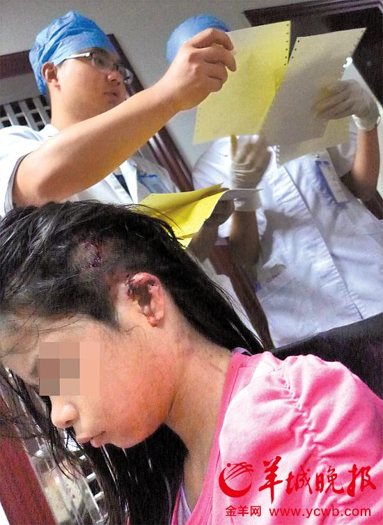 受傷的11歲女孩頭發(fā)被卷入扶梯，耳朵被嚴(yán)重拉傷，需手術(shù)。