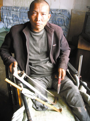 鄭艷良就是用這幾樣簡陋工具，給自己做了右腿截肢手術。