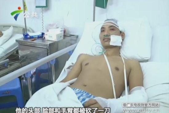 另一名傷者頭部、臉部和手臂都被砍了一刀。(視頻截圖)