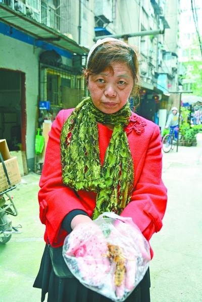 頭部受傷的黃女士展示兩根大魚刺。