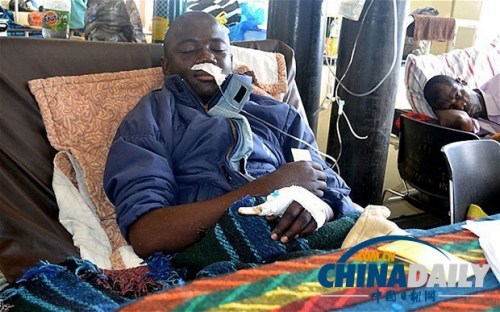 雖然已經(jīng)在醫(yī)院接受了近一個(gè)月的恢復(fù)治療，卡托卡的身體仍然非常虛弱。