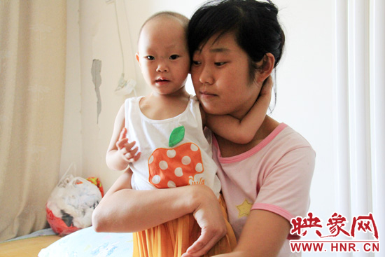 孩子和媽媽在一起，她的右眼已經(jīng)失明。