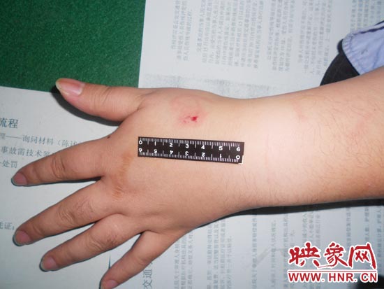 為幫助無證駕駛的朋友逃避處罰，新鄉(xiāng)的王某竟對執(zhí)勤民警大打出手，還將一名民警的手臂咬傷