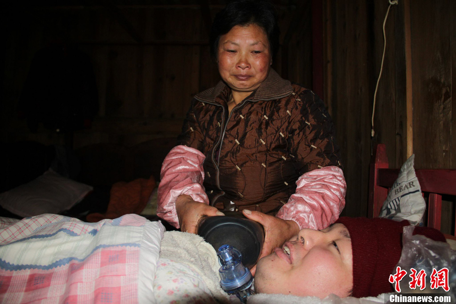 父母為癱瘓兒子自制呼吸機 手捏呼吸球5年不輟