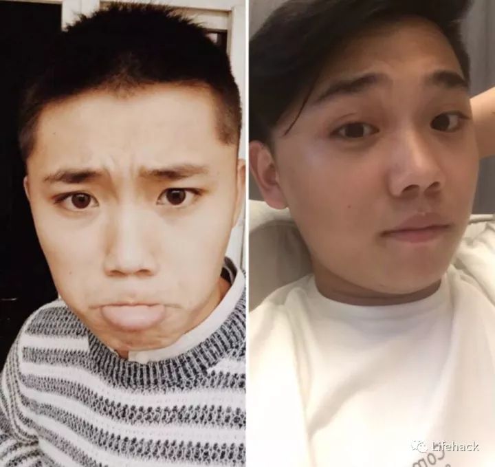 長胖20斤，臉型怎么變？這些例子看完扎心了！