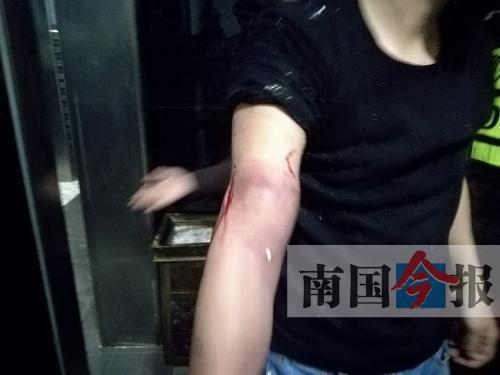 覃先生手臂被卡的部位受傷流血，所幸傷勢無大礙。 通訊員 王建民 攝