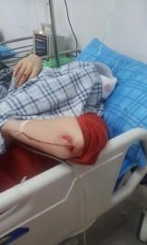砸窗當(dāng)事人胡女士在醫(yī)院接受治療。