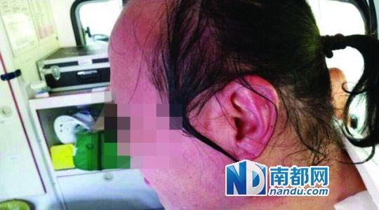 涉事教師遭熱水潑臉后的照片。