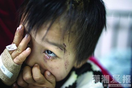 1月13日，湖南省兒童醫(yī)院，4歲的源源用手蒙住了眼睛。