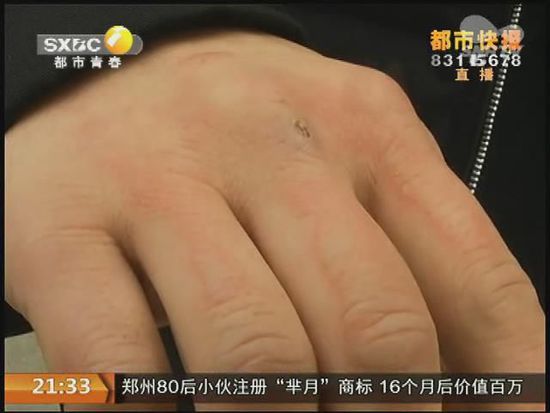 說到這足療拔罐，估計大伙都不陌生，但是想起4號晚上的拔罐的經(jīng)歷，呂先生現(xiàn)在想起來，還心有余悸。