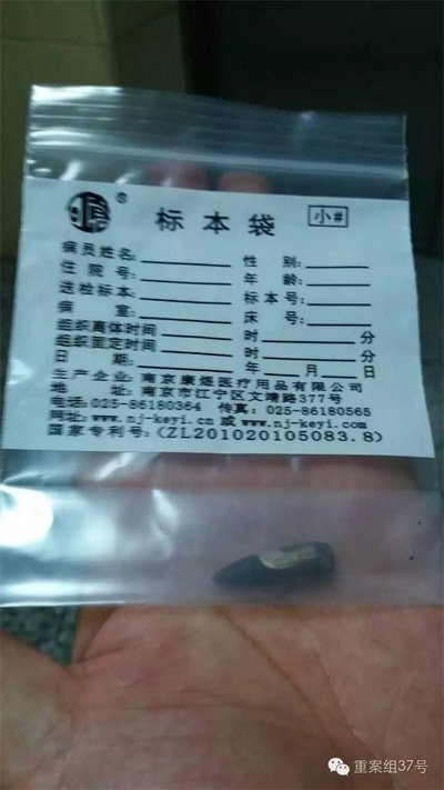 經(jīng)警方鑒定，秦女士體內(nèi)取出的子彈系56式步槍射出 。 受訪者供圖