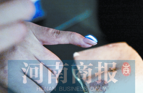 將指甲油涂在指甲上，靠近火焰時被引燃了